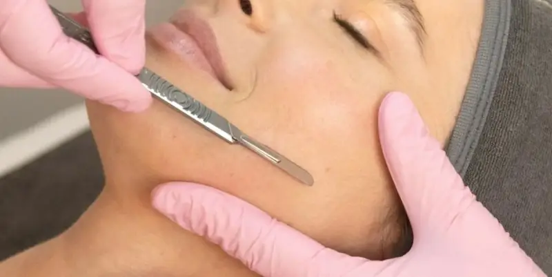 Dermaplaning Facial Sarasota