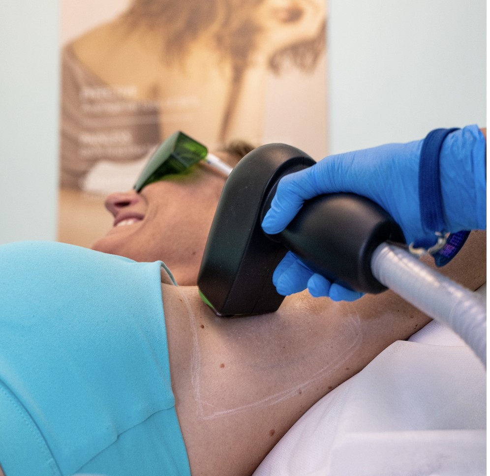 Laser hair removal in Clearwater