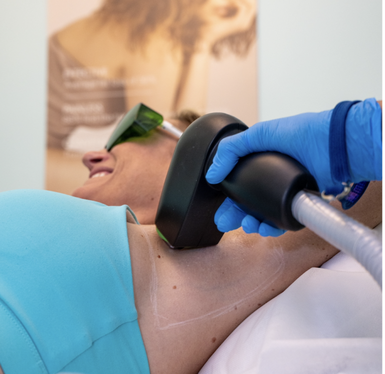 Laser hair removal at Cryo Studio Sarasota
