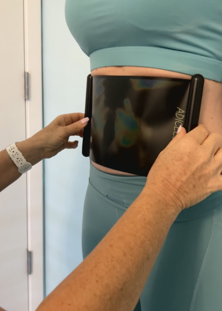 Contact thermography assessment at Cryo Studio Sarasota