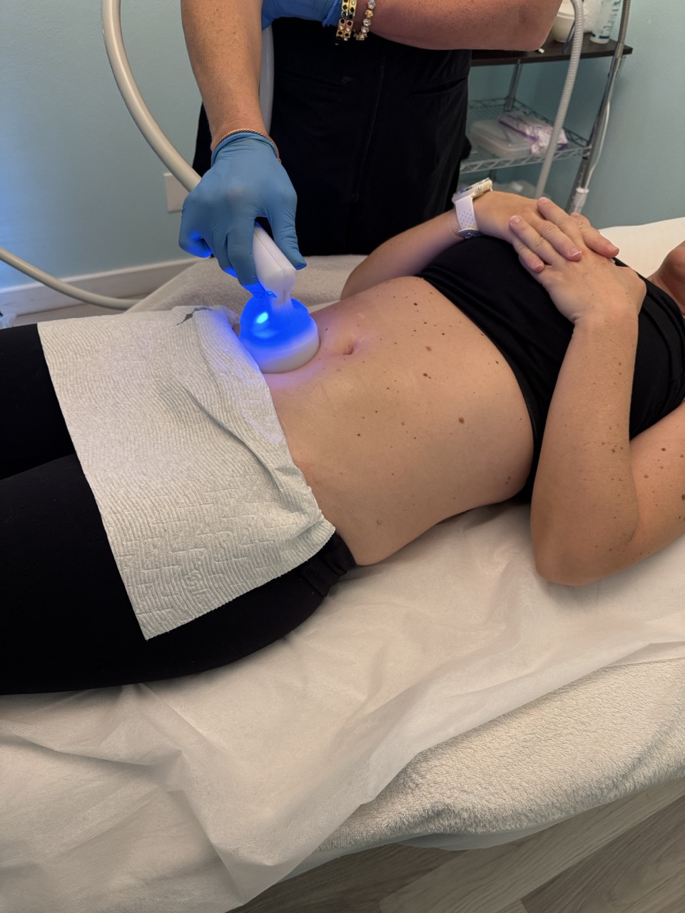 Cryo Toning skin-firming treatment at Cryo Studio Sarasota