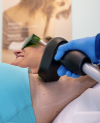 Laser hair removal at Cryo Studio Sarasota
